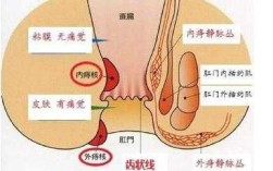 痔疮在哪里长着（痔疮在哪里长着呢图片）