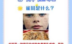 脸上的雀斑怎么去掉？有什么快速方法吗,去除雀斑哪里好