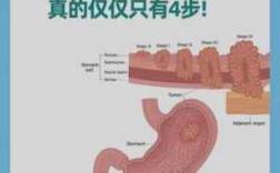 义乌看胃病哪里好（义乌看胃病哪里好一点）