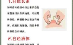 痘痘应该怎么挤,挤痘痘去哪里挤