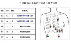 心电图贴哪里（心电图要贴哪里）