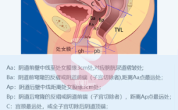 阴道壁在哪里（阴壁有许多颗粒是什么原因）