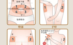 胰岛素一定要注射到皮下组织吗？为什么,胰岛素打哪里吸收好一点