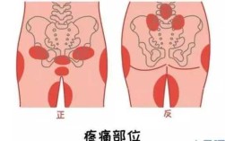 孕妇骨盆疼是怎么回事,孕妇骨盆在哪里图片