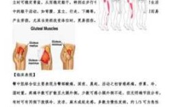 筋膜炎需要练哪里的肌肉,炎是哪里的简称