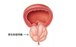 前列腺长在什么地方,男人疣体会长在哪里