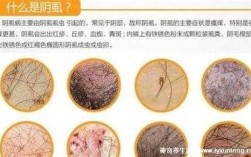 阴虱是哪里痒（阴虱是哪里痒 里边还是外边）