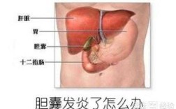 胆囊炎哪里疼「胆囊炎哪里疼位置图」