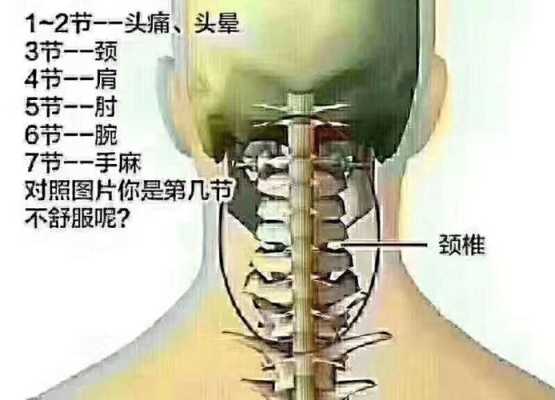 哪里是颈椎（哪里是颈椎）-图1