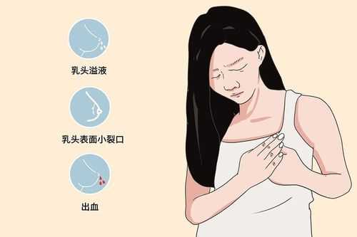 乳头是哪里（乳头是哪里）-图1