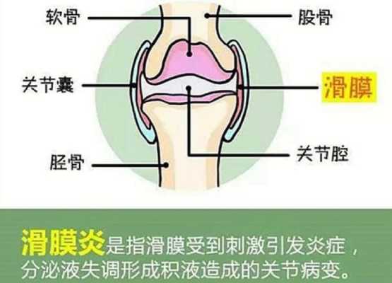 哪里治滑膜炎（哪里治滑膜炎最好的医院）-图1