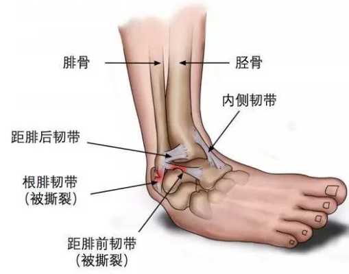 腓骨在哪里（腓骨部位有隐痛状况）-图2