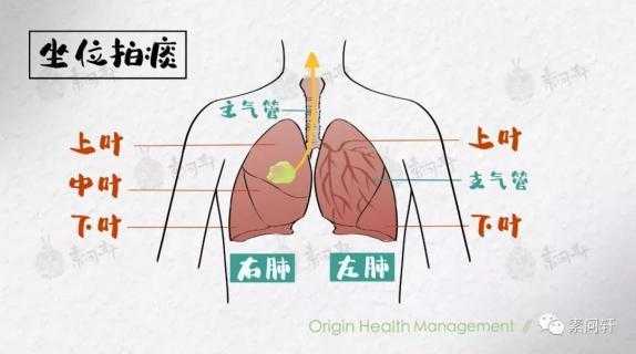 痰在人体的什么位置？为什么有人咳也咳不完,痰是如何产生的痰来自哪里-图2