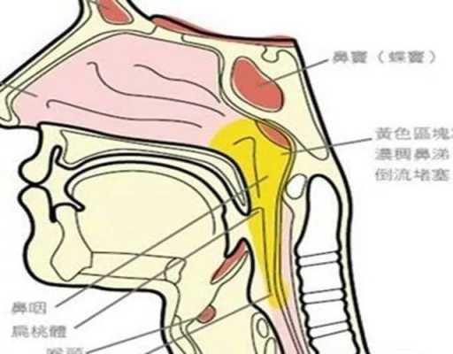 痰在人体的什么位置？为什么有人咳也咳不完,痰是如何产生的痰来自哪里-图3