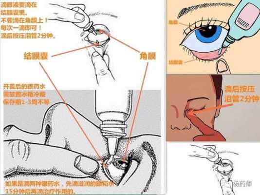 眼药水滴在哪里（眼药水滴在哪里）-图2