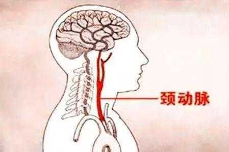 颈部在哪里图片（颈部在哪里图片会打晕吗）-图3