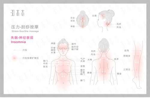 失眠刮痧刮哪里（失眠刮痧刮哪里图解）-图1