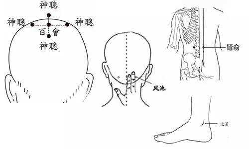 失眠刮痧刮哪里（失眠刮痧刮哪里图解）-图3