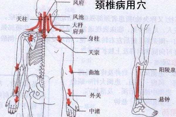 颈椎的反射区在哪里（颈椎病一般哪里痛）-图2