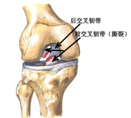 哪里看韧带（哪里看韧带比较好的医院）-图1