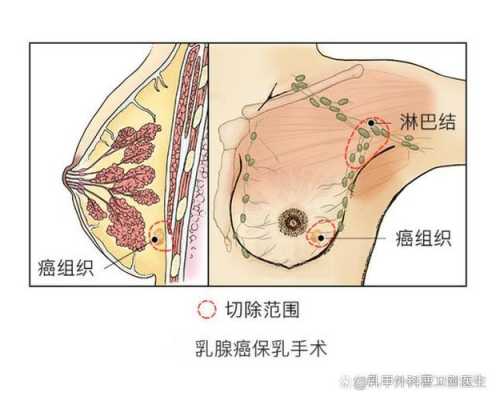 乳房长在哪里（乳房长在什么位置）-图1