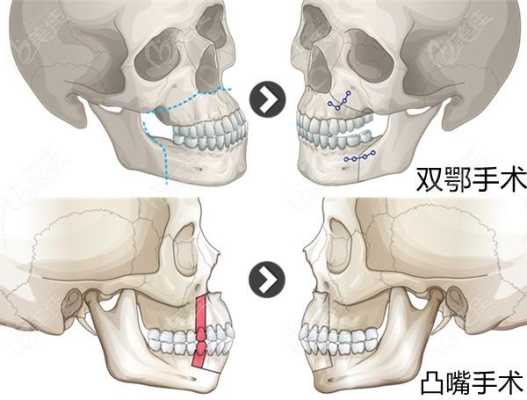 双鄂是哪里（双鄂是哪个部位）-图2