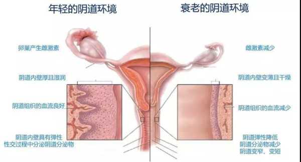 阴道前壁和阴道后壁总长是多少,-图2