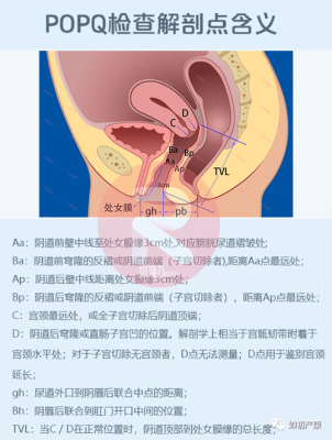 阴道前壁和阴道后壁总长是多少,-图1