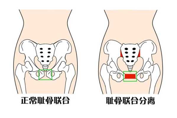 耻骨联合在哪里图片（耻骨联合在哪里图片 位置图）-图3