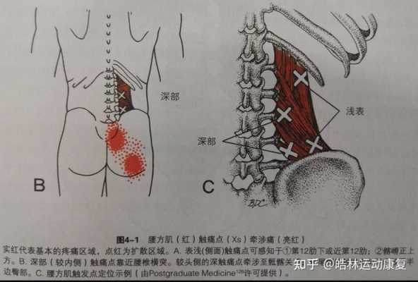 筋膜炎需要练哪里的肌肉,炎是哪里的简称-图2