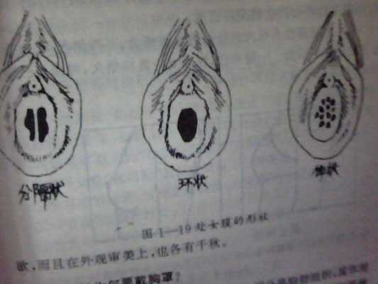 处女膜到底在哪里-图3