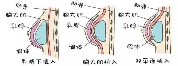 乳沟在哪里（乳沟在哪里）-图2