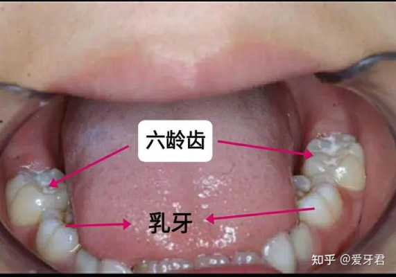 哪里有幼齿（哪有牙齿）-图2