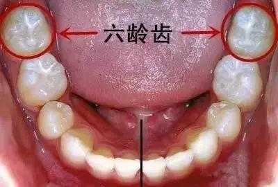 哪里有幼齿（哪有牙齿）-图1