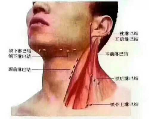 什么是淋巴结，一般长在什么地方,淋巴是哪里图片-图2