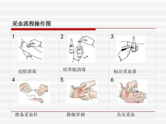 医院抽血在哪里（医院的抽血流程是怎样的）-图3