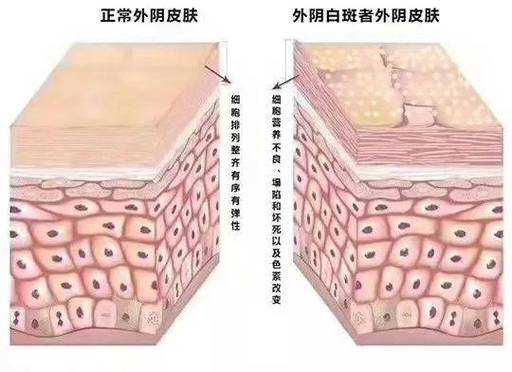 女外阴是哪里（女性外阴有多少种）-图2