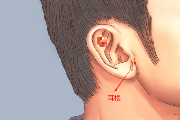 耳根在哪里图解（耳根在哪 图解）-图1