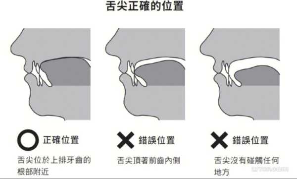 舌头放在哪里（舌头放在哪里才是正确的）-图1