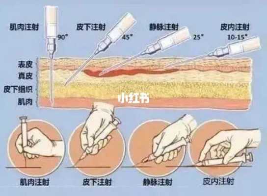 猫咪打针打哪里（猫咪打针打哪里）-图1