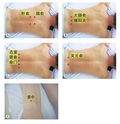 腰酸艾灸哪里（现在人们只要腰腿疼，都用艾灸去灸，真的管用吗）-图3