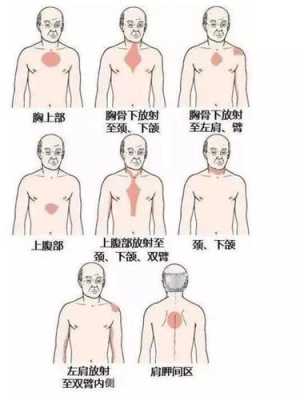 胸闷在哪里（胸闷在哪里）-图2