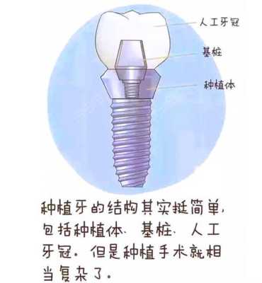 西安哪里种牙好（西安哪里种牙好而且不贵）-图1