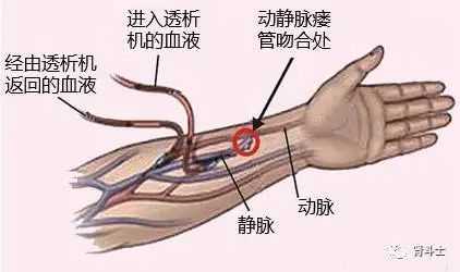 手腕的静脉在哪里（手腕的静脉在哪里）-图2