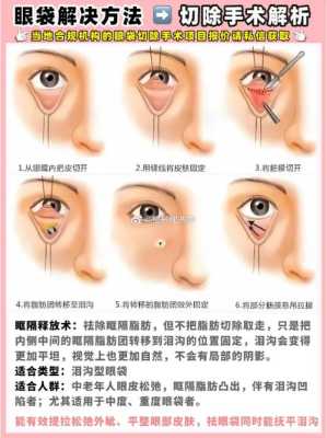 眼袋手术内切和外切哪个好,做眼袋切除手术哪里好点-图1