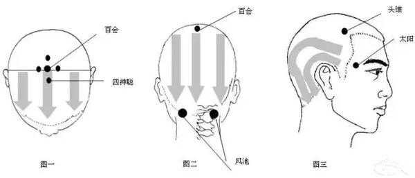 头晕刮痧刮哪里（头晕刮痧刮哪里最好视频）-图2