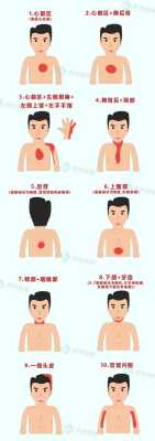 心绞痛主要临床表现有哪些,心绞痛哪里疼位置图-图1