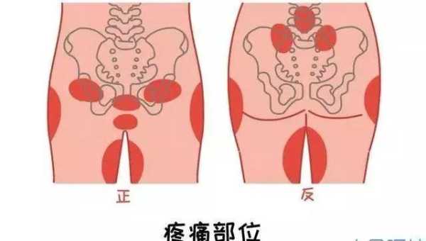 孕妇骨盆疼是怎么回事,孕妇骨盆在哪里图片-图1