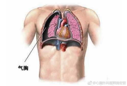 肺尖在哪里（肺尖在哪里图片）-图1