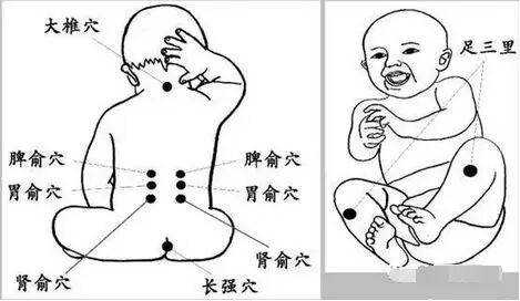 小孩感冒咳嗽怎样刮痧,感冒咳嗽刮痧刮哪里图解-图1